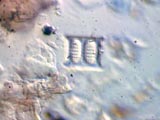 Diatom, Aulacoseira (Melosira)